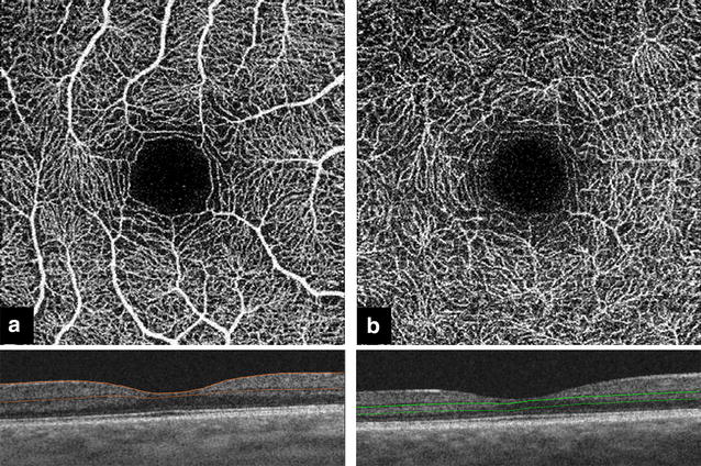 Fig. 1