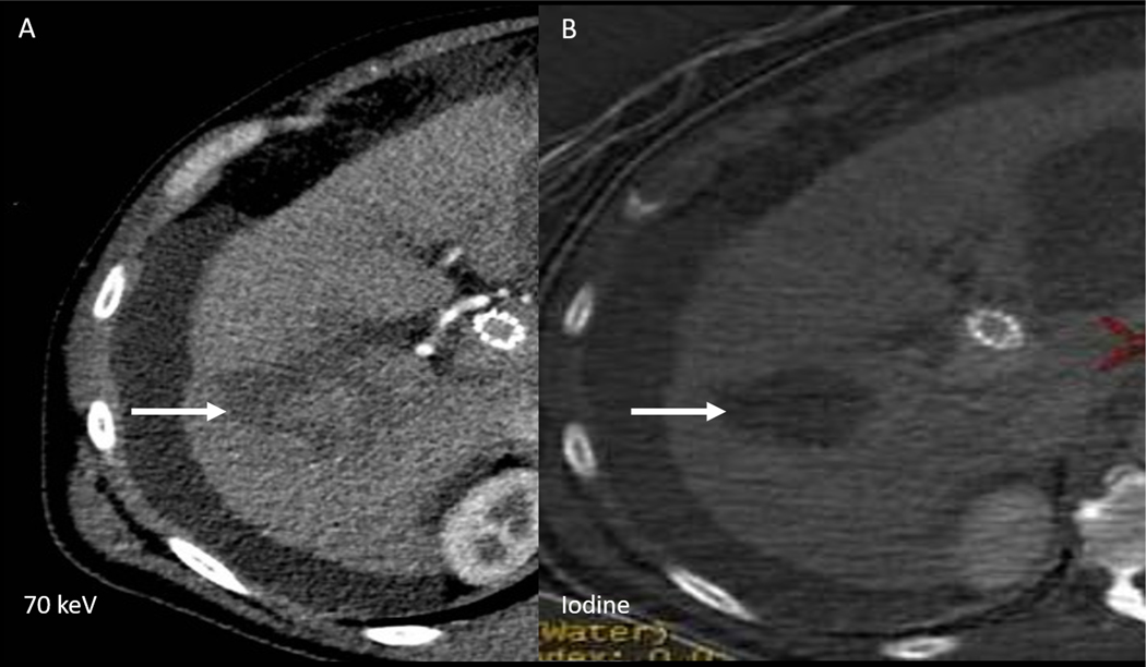 Figure 6: