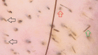 Fig. 2