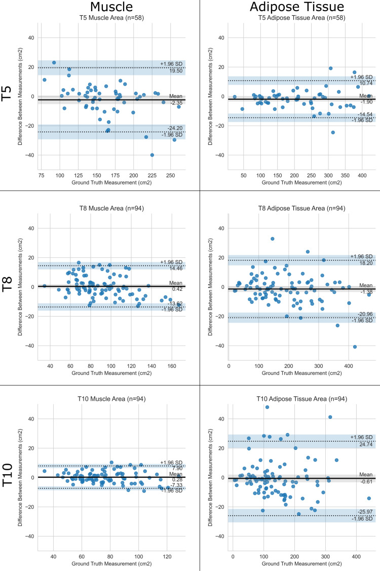 Performance of the pipeline for cross-sectional area. Bland-Altman plots show agreement between the predicted and ground truth muscle and adipose tissue cross-sectional areas at T5, T8, and T10 vertebral bodies. The pipeline is compared with human analysts. SD = standard deviation.