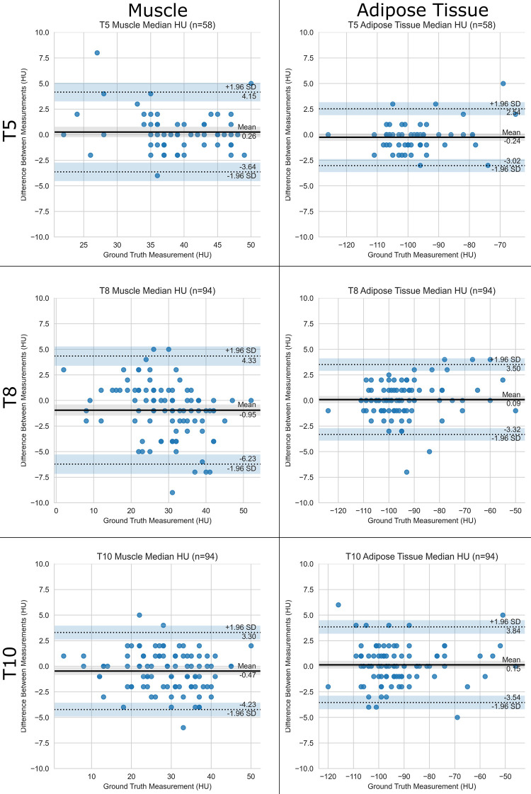 Performance of the pipeline for median attenuation. Bland-Altman plots show agreement between predicted and ground truth muscle and adipose tissue median attenuation at T5, T8, and T10 vertebral bodies. The pipeline is compared with human analysts. SD = standard deviation.