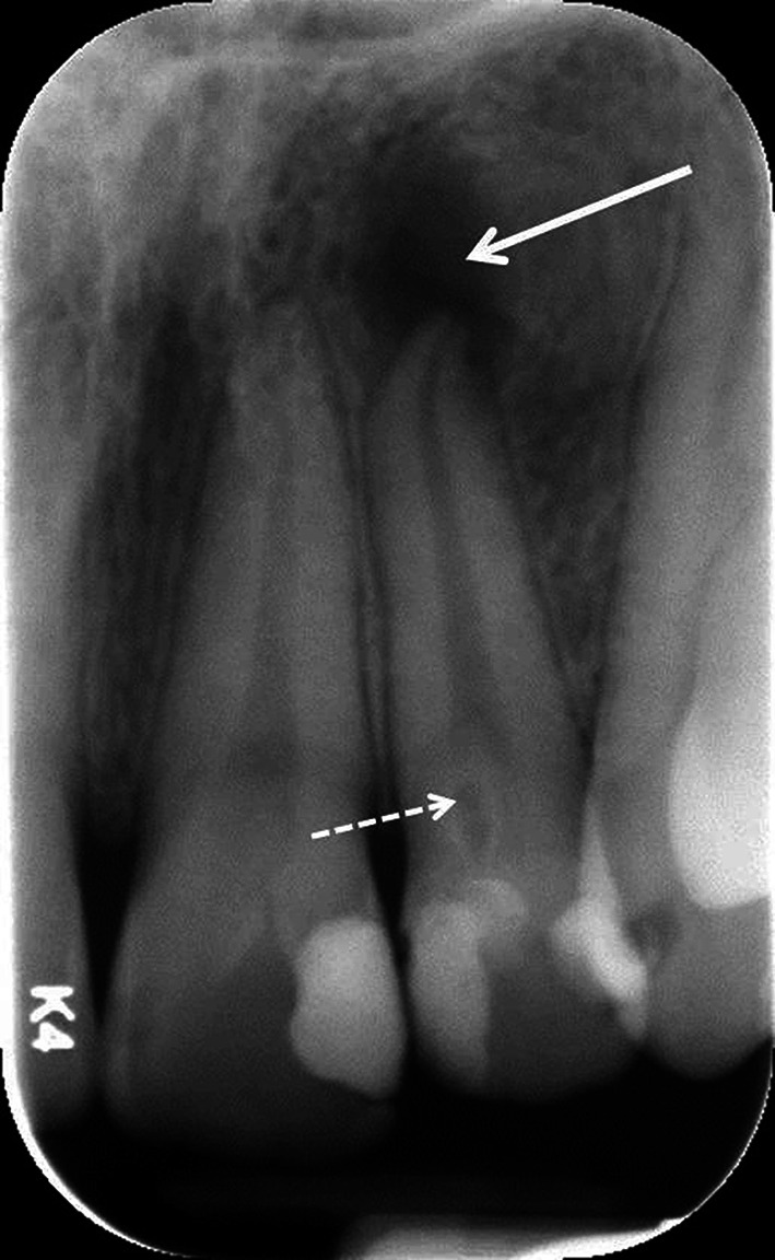 Fig. 1