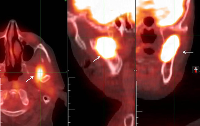 Fig. 11