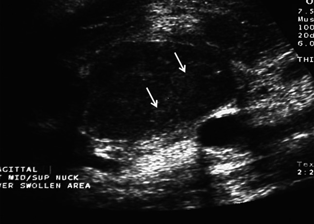 Fig. 15