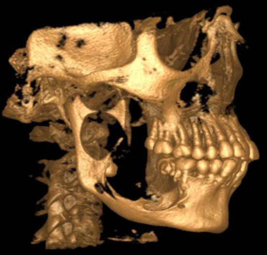 Fig. 4