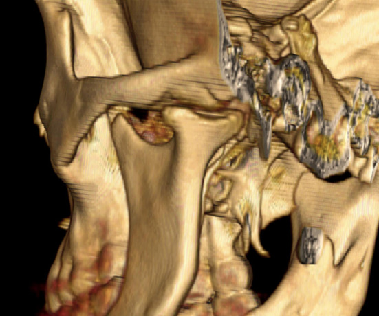 Fig. 10