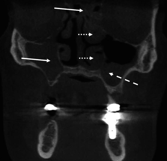 Fig. 6
