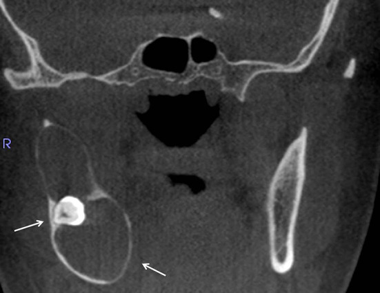 Fig. 3