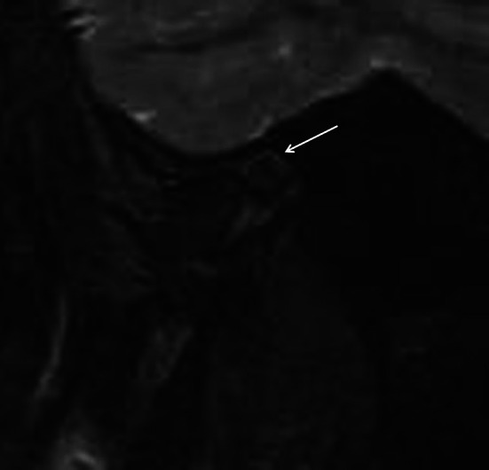Fig. 13