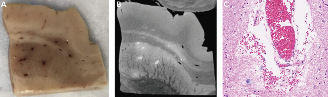 FIGURE 11-1