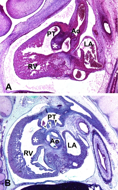 Fig. 11