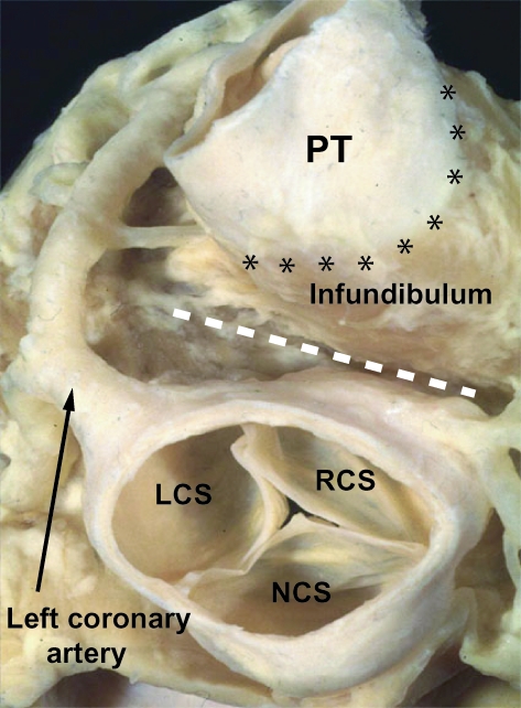 Fig. 13