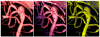 Fig. 12