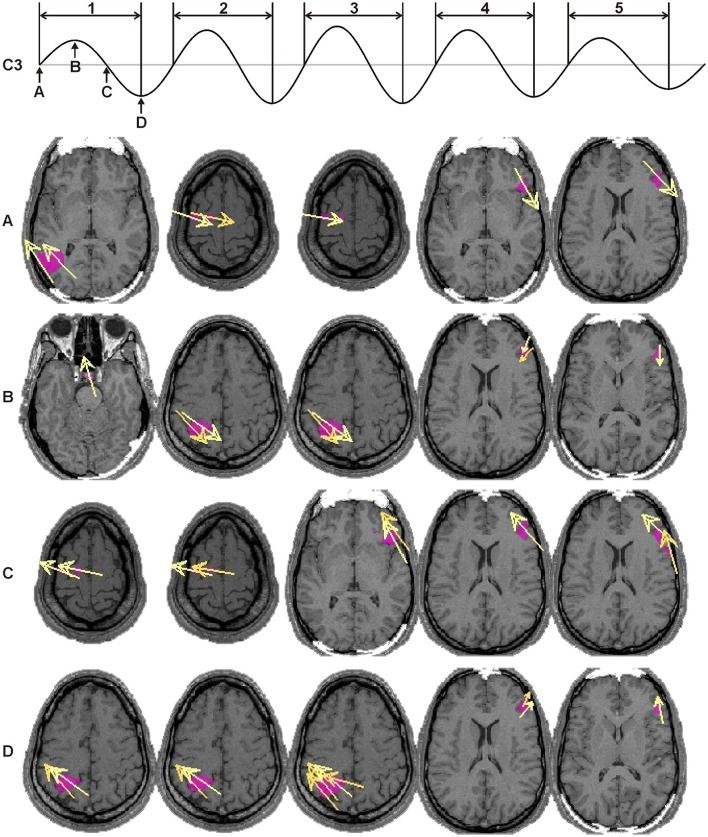 Figure 13