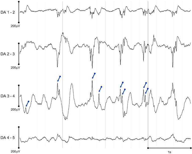 Fig. 1