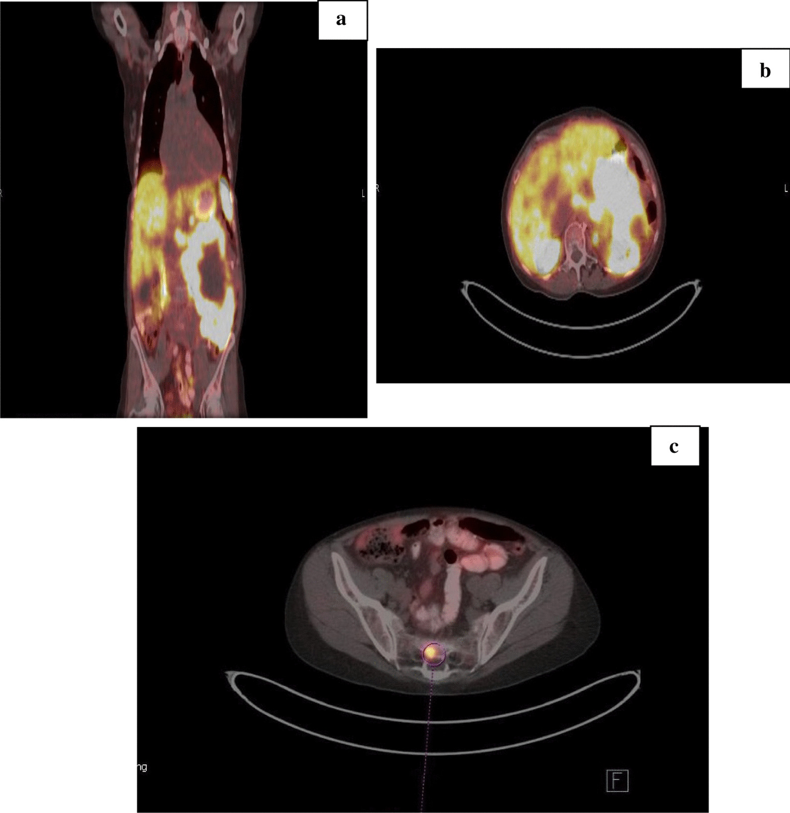 Fig. 2