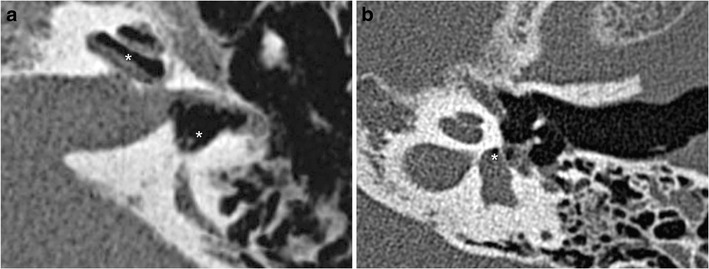 Fig. 10