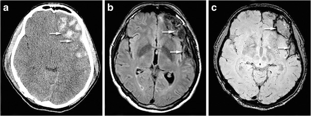 Fig. 13