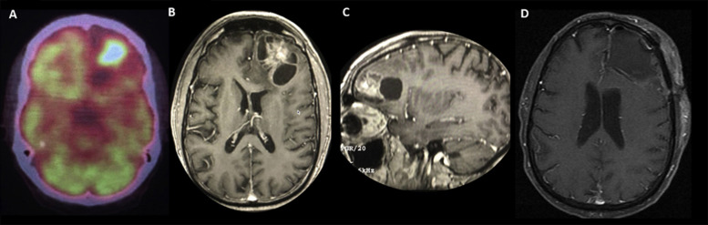 Supplementary Figure 1