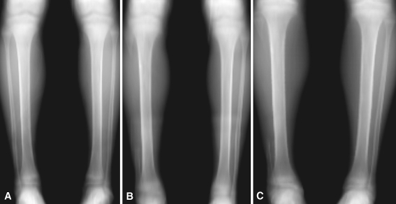 Fig. 1A–C