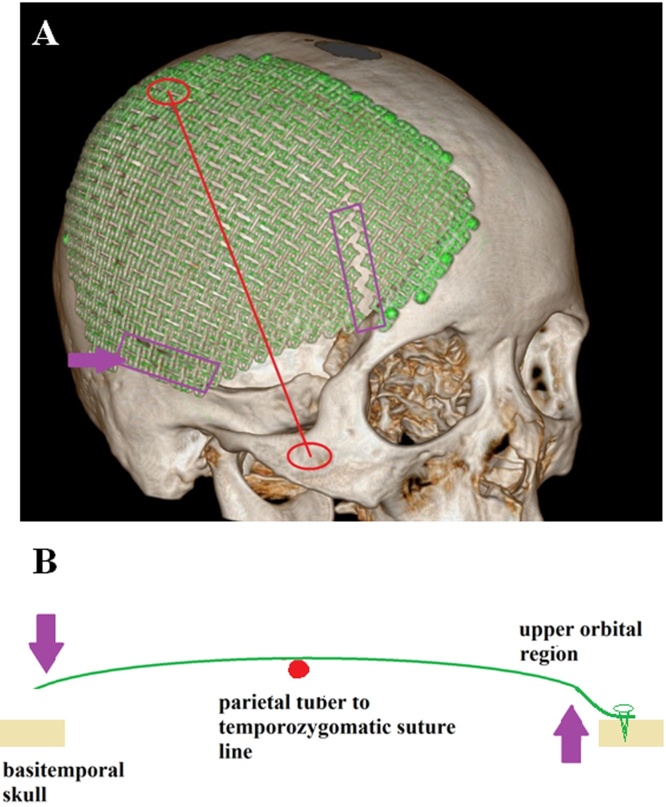 Fig. 4