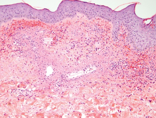 Fig. 7.3