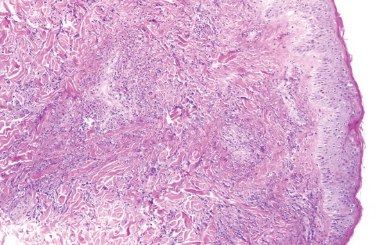 Fig. 7.33