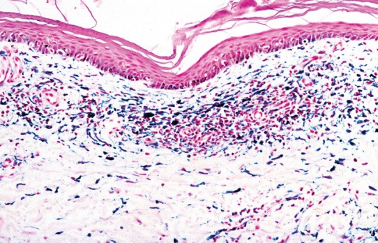 Fig. 7.41