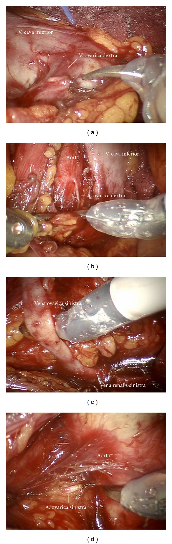 Figure 26