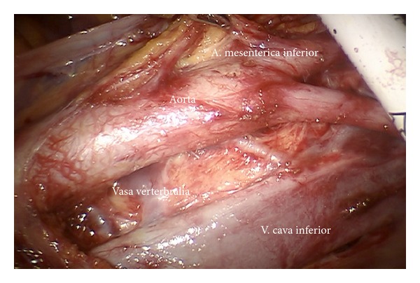 Figure 22