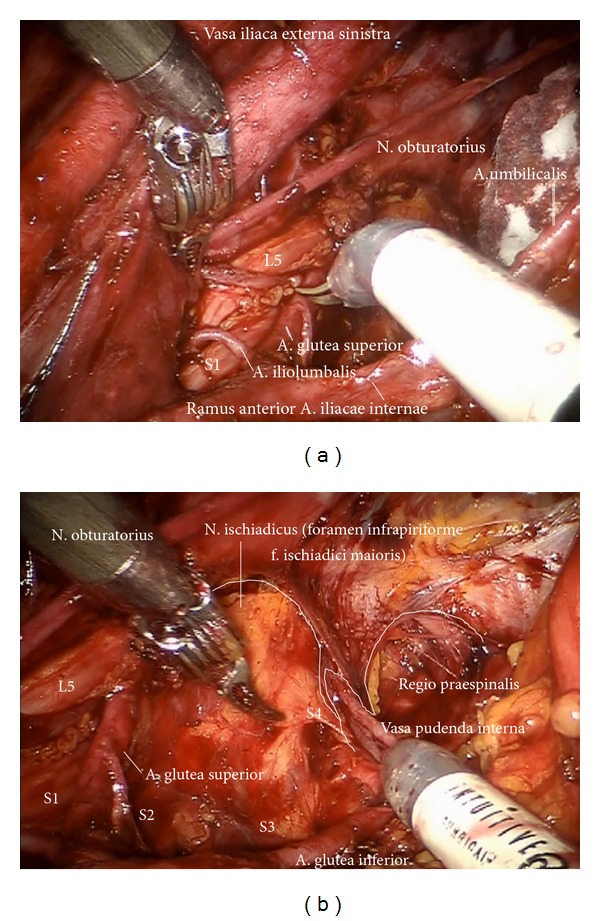 Figure 16