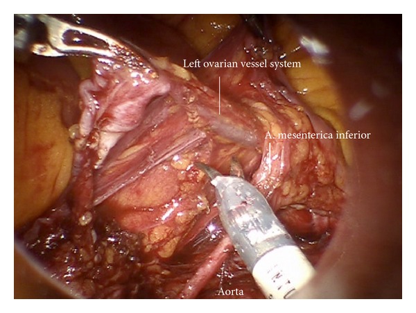 Figure 27