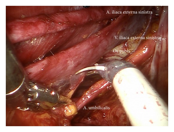 Figure 15