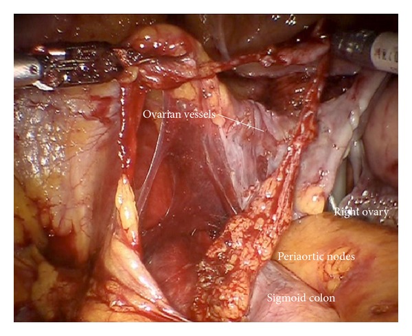 Figure 30