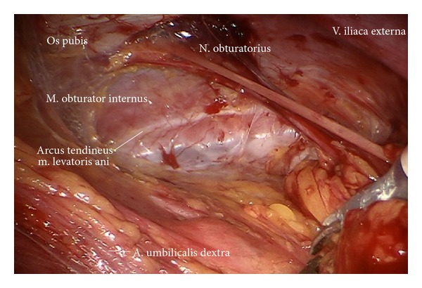 Figure 13