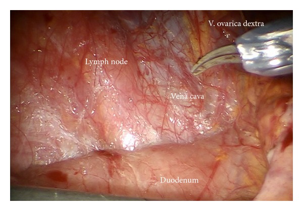 Figure 25