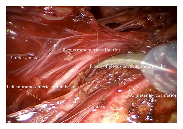 Figure 29