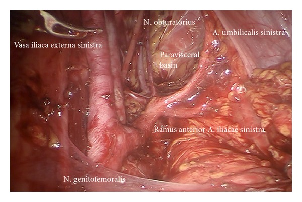 Figure 17