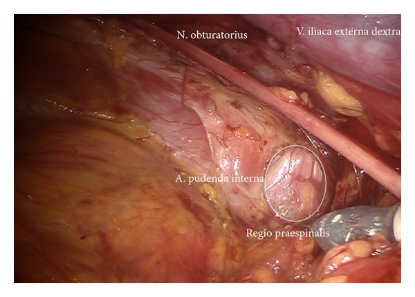 Figure 14