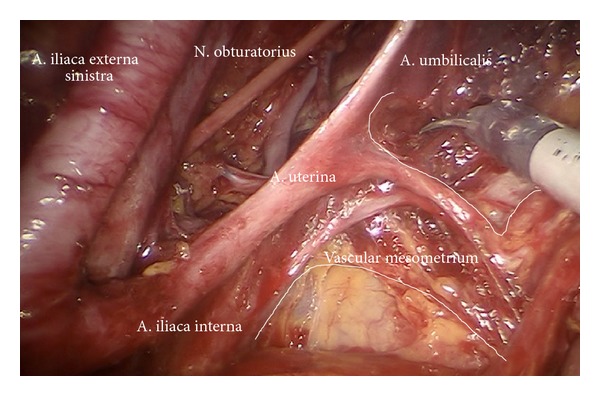 Figure 18