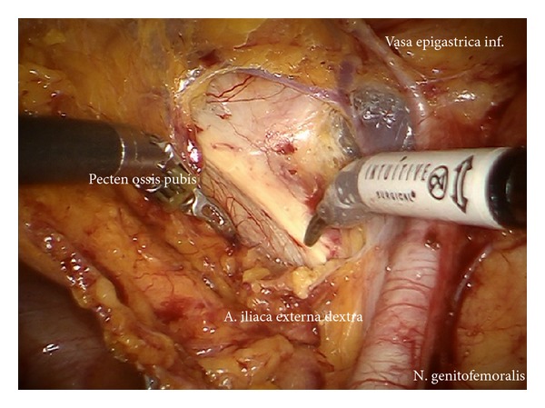 Figure 11