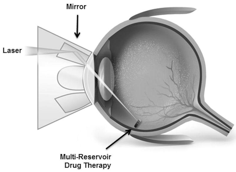 Fig. 17