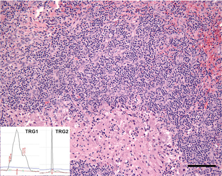 FIGURE 4