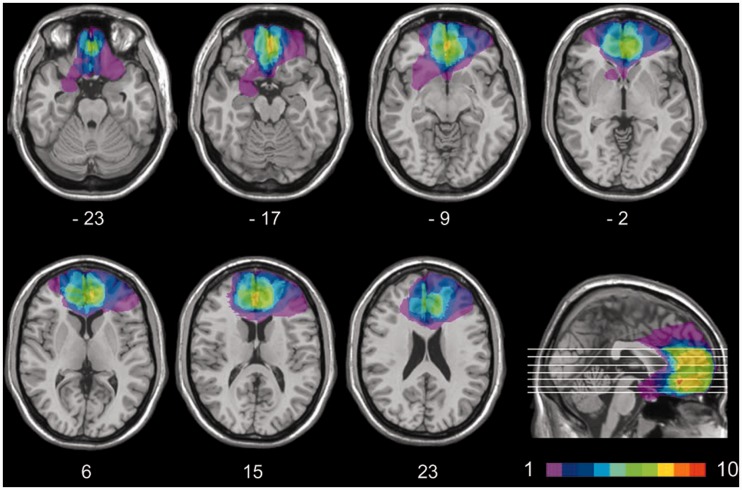 Fig. 1