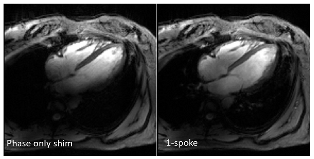 Fig. 11.