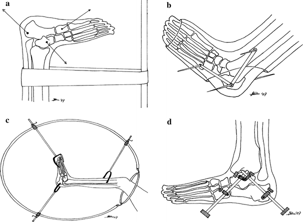 Fig. 3