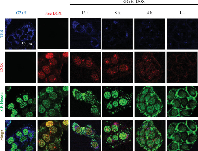 CLSM images of HepG2 cells treated with blank.