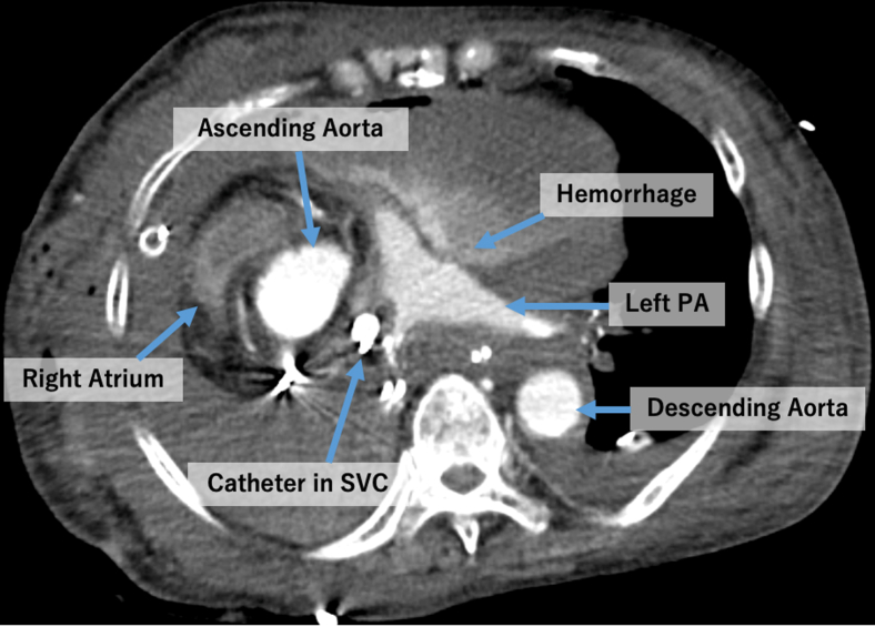 Figure 2