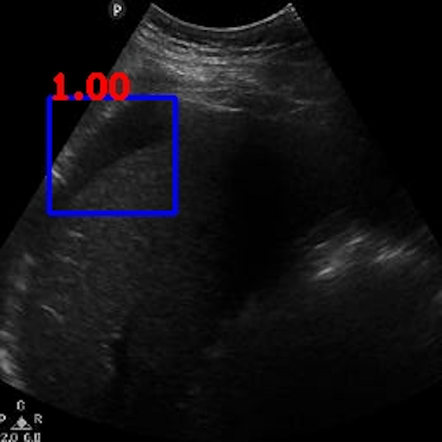 Fig. 10