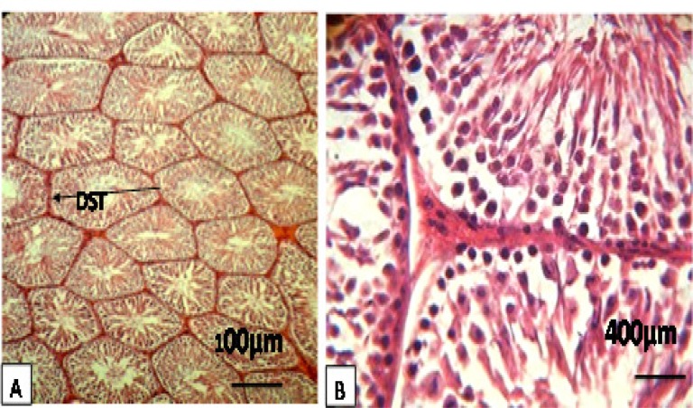 Figure. 1 A, B